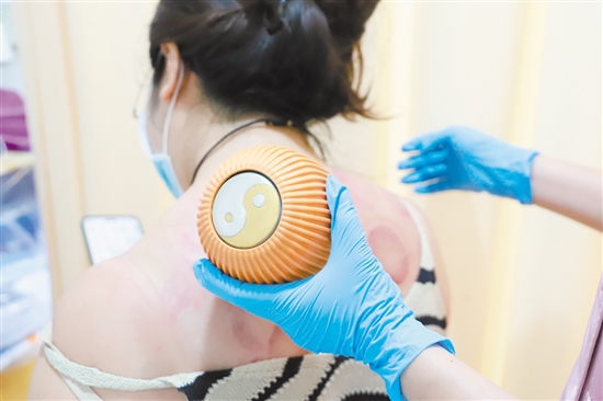 医护人员在夜间门诊为患者拔火罐。 医护人员在夜间门诊为患者拔火罐。