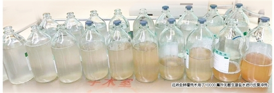 这场全肺灌洗术用了10000毫升无菌生理盐水进行反复冲洗。 这场全肺灌洗术用了10000毫升无菌生理盐水进行反复冲洗。