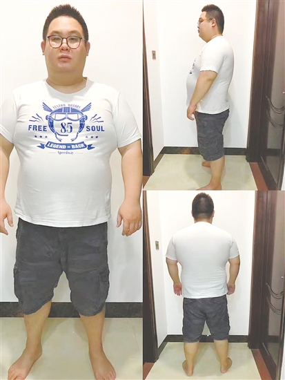 “肥仔医生”大变样。 “肥仔医生”大变样。