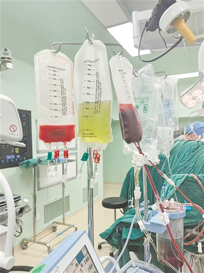 回收机内的血小板、血浆、红细胞。 回收机内的血小板、血浆、红细胞。